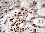 TOP2A Antibody in Immunohistochemistry (Paraffin) (IHC (P))