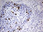 TOP2A Antibody in Immunohistochemistry (Paraffin) (IHC (P))