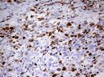 TOP2A Antibody in Immunohistochemistry (Paraffin) (IHC (P))