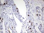 TOP2A Antibody in Immunohistochemistry (Paraffin) (IHC (P))