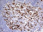 TOP2A Antibody in Immunohistochemistry (Paraffin) (IHC (P))