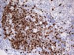 TOP2A Antibody in Immunohistochemistry (Paraffin) (IHC (P))