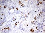 TOP2A Antibody in Immunohistochemistry (Paraffin) (IHC (P))