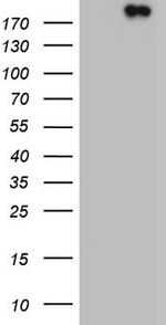 TOP2A Antibody in Western Blot (WB)