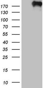 TOP2A Antibody in Western Blot (WB)