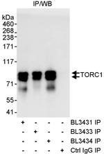 TORC1 Antibody in Immunoprecipitation (IP)