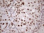 TP53BP1 Antibody in Immunohistochemistry (Paraffin) (IHC (P))