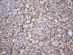 TP53BP1 Antibody in Immunohistochemistry (Paraffin) (IHC (P))