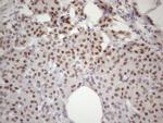 TP53BP1 Antibody in Immunohistochemistry (Paraffin) (IHC (P))