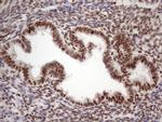 TP53BP1 Antibody in Immunohistochemistry (Paraffin) (IHC (P))