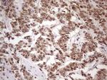 TP53BP1 Antibody in Immunohistochemistry (Paraffin) (IHC (P))