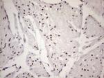 TP53BP1 Antibody in Immunohistochemistry (Paraffin) (IHC (P))