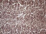 TP53BP1 Antibody in Immunohistochemistry (Paraffin) (IHC (P))