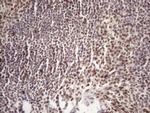 TP53BP1 Antibody in Immunohistochemistry (Paraffin) (IHC (P))