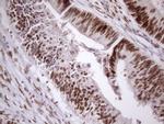 TP53BP1 Antibody in Immunohistochemistry (Paraffin) (IHC (P))