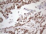 TP53BP1 Antibody in Immunohistochemistry (Paraffin) (IHC (P))