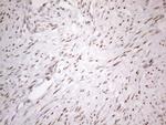 TP53BP1 Antibody in Immunohistochemistry (Paraffin) (IHC (P))