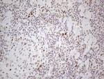 TP53BP1 Antibody in Immunohistochemistry (Paraffin) (IHC (P))