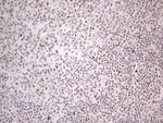 TP53BP1 Antibody in Immunohistochemistry (Paraffin) (IHC (P))