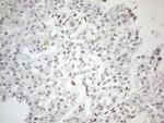 TP53BP1 Antibody in Immunohistochemistry (Paraffin) (IHC (P))