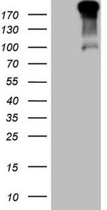 TP53BP1 Antibody in Western Blot (WB)