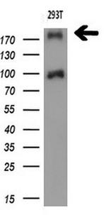 TP53BP1 Antibody in Western Blot (WB)