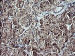 TP73 Antibody in Immunohistochemistry (Paraffin) (IHC (P))