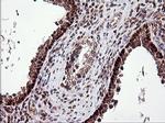 TP73 Antibody in Immunohistochemistry (Paraffin) (IHC (P))