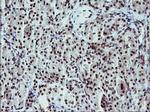 TP73 Antibody in Immunohistochemistry (Paraffin) (IHC (P))