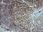 TP73 Antibody in Immunohistochemistry (Paraffin) (IHC (P))