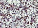 TP73 Antibody in Immunohistochemistry (Paraffin) (IHC (P))