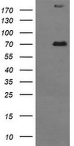 TP73 Antibody in Western Blot (WB)