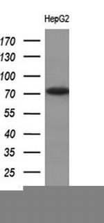 TP73 Antibody in Western Blot (WB)