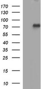 TP73 Antibody in Western Blot (WB)