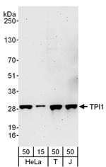 TPI1 Antibody in Western Blot (WB)