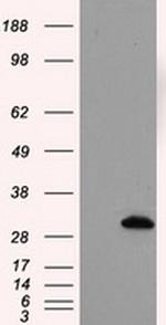 TPMT Antibody in Western Blot (WB)