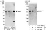 TPP1 Antibody in Western Blot (WB)