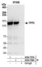 TPP2 Antibody in Immunoprecipitation (IP)