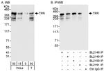 TPR Antibody in Western Blot (WB)