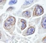 TPR Antibody in Immunohistochemistry (IHC)