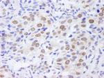 TPR Antibody in Immunohistochemistry (IHC)