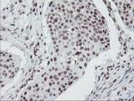 TPRKB Antibody in Immunohistochemistry (Paraffin) (IHC (P))