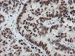 TPRKB Antibody in Immunohistochemistry (Paraffin) (IHC (P))