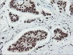 TPRKB Antibody in Immunohistochemistry (Paraffin) (IHC (P))