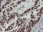 TPRKB Antibody in Immunohistochemistry (Paraffin) (IHC (P))