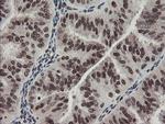 TPRKB Antibody in Immunohistochemistry (Paraffin) (IHC (P))