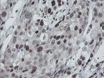 TPRKB Antibody in Immunohistochemistry (Paraffin) (IHC (P))