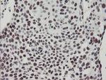 TPRKB Antibody in Immunohistochemistry (Paraffin) (IHC (P))