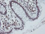 TPRKB Antibody in Immunohistochemistry (Paraffin) (IHC (P))