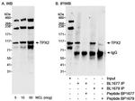 TPX2 Antibody in Western Blot (WB)